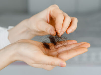 Perte de cheveux femme : retrouver confiance à Périgueux